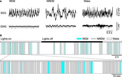 Neural and Homeostatic Regulation of REM Sleep